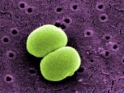 Batteri: scoperto come diventano resistenti agli antibiotici batteri-scoperto-come-diventano-resistenti-antibiotici