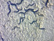 Longevità: grazie a un verme vivremo fino a 500 anni longevita-grazie-a-un-verme-vivremo-fino-a-500-anni