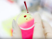 Fase 2 e Coronavirus: i test sierologici ci salveranno? fase-2-coronavirus-test-sierologici-ci-salveranno